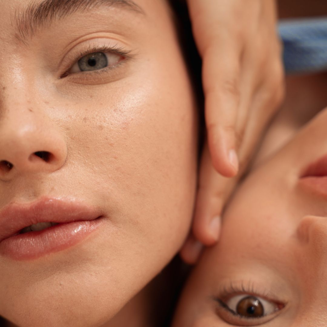 Améliorer la beauté et la qualité de la peau grâce à une santé intestinale optimale