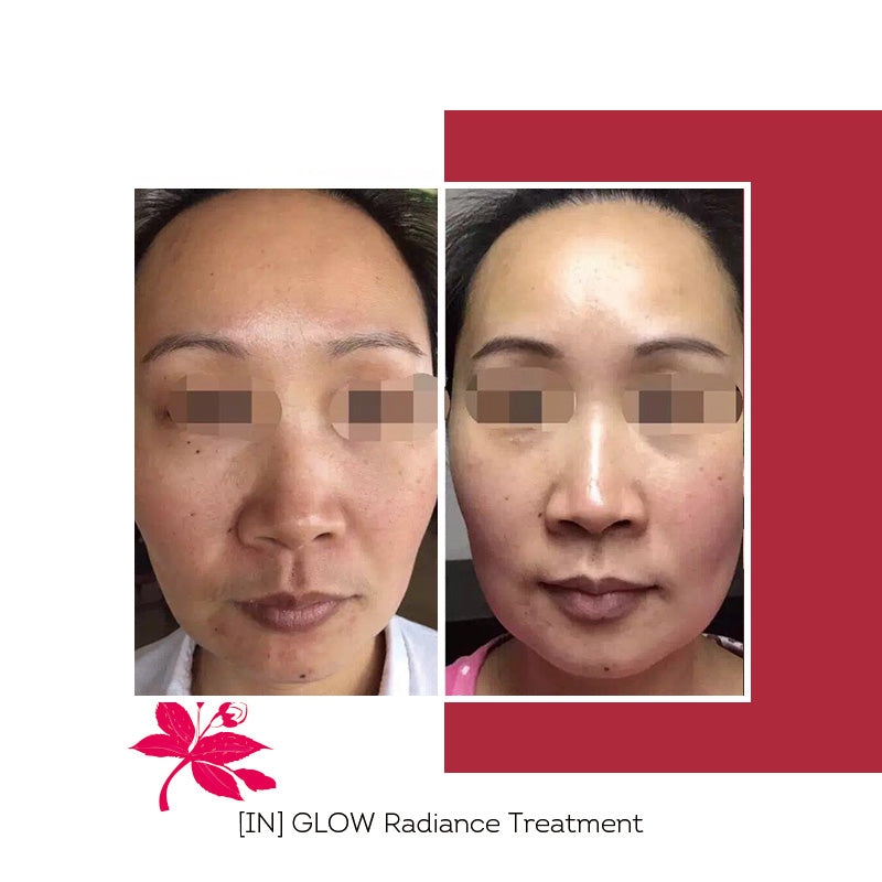 Nouveau [IN] GLOW Cure Éclat