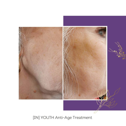 IN YOUTH - Soin Anti-Âge & Anti-Fatigue