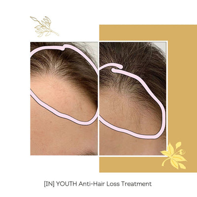[IN] Youth - Cure antichute cheveux (nouvelle formule !)
