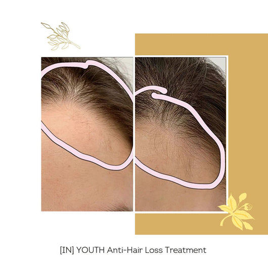 [IN] Youth - Cure antichute cheveux (nouvelle formule !)