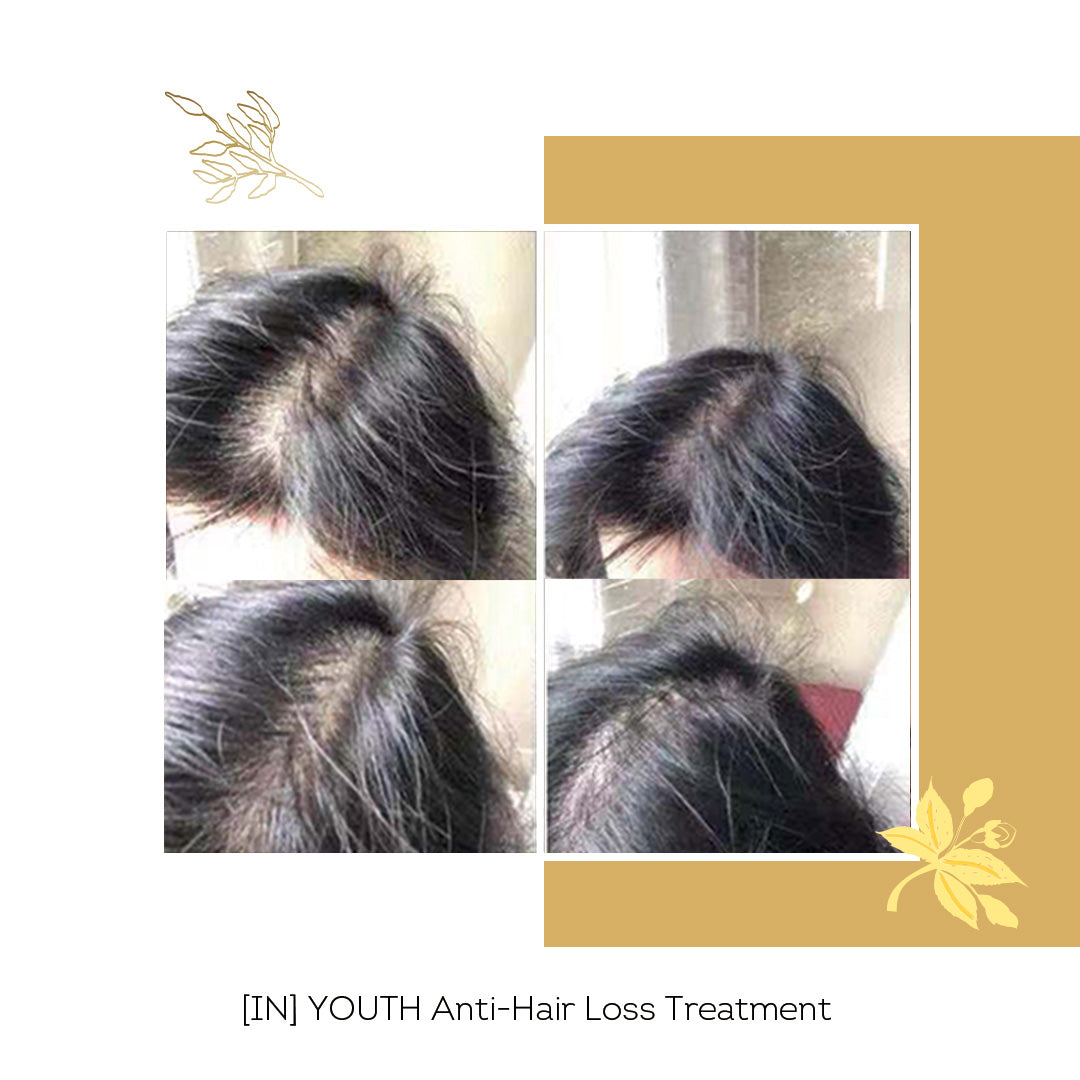 [IN] YOUTH Cure Anti-Chute Cheveux
