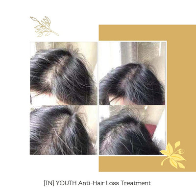 [IN] Youth - Cure antichute cheveux (nouvelle formule !)