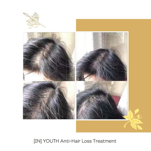 [IN] Youth - Cure antichute cheveux (nouvelle formule !)