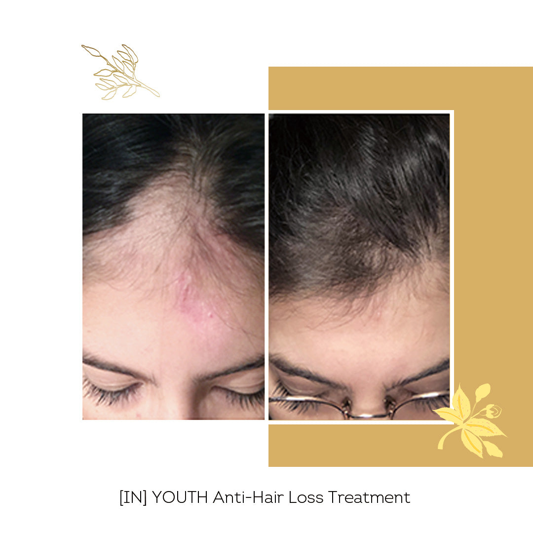 [IN] YOUTH Cure Anti-Chute Cheveux